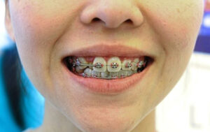 oral_examination